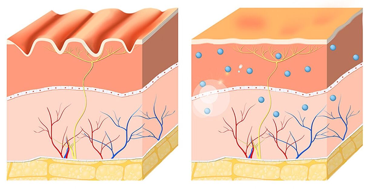 Inno Gialuron yana ko da da kuma moisturize epidermis