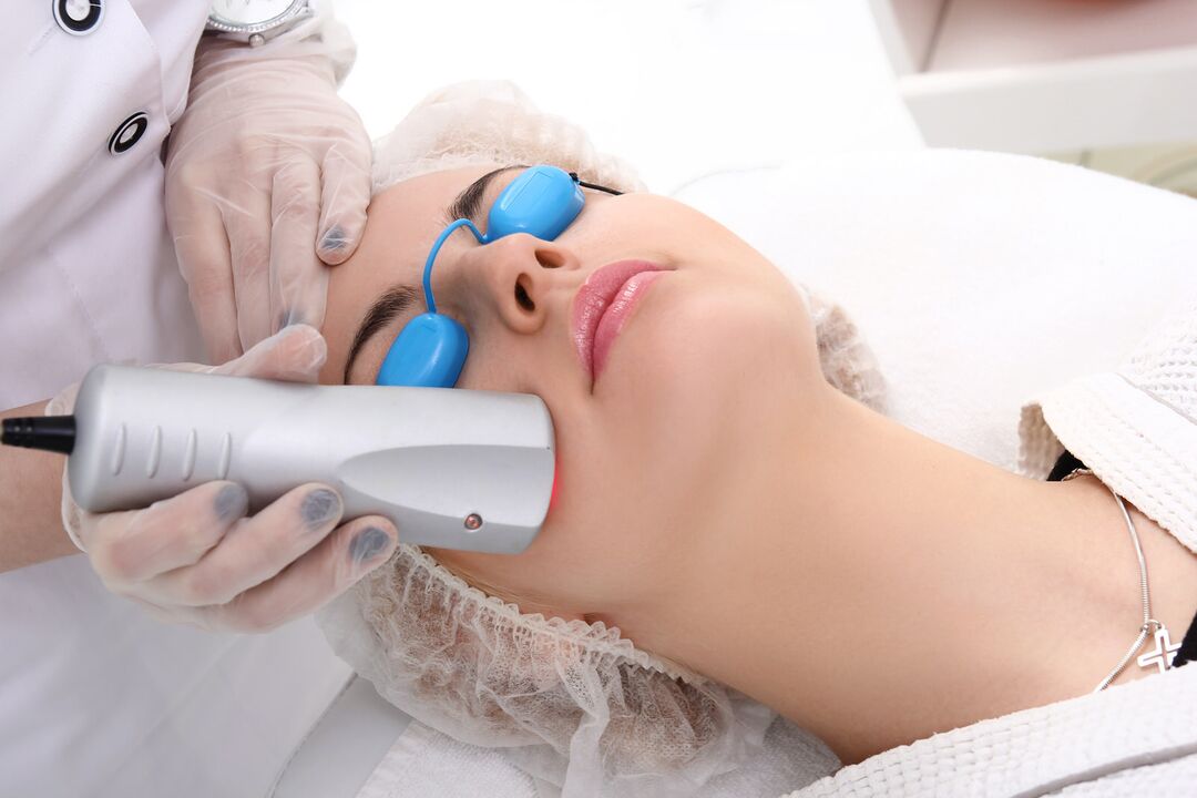 Laser fata rejuvenation