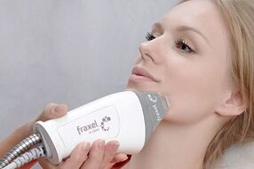 ainihin tsarin gyaran fatar fuska mai juzu'i